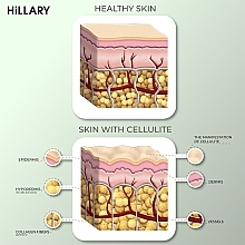 Антицеллюлитные обертывания с охлаждающим эффектом - Hillary Anti-cellulite Bandage Cooling Effect — фото N2