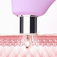 Прибор для микродермабразии и очистки пор - Foreo Kiwi Derma Diamond Microdermabrasion & Pore Vacuum Device — фото N5