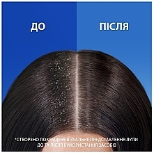 Шампунь проти лупи "Захист від випадіння волосся з кофеїном" - Head & Shoulders Pro-Expert 7 With Caffeine — фото N3