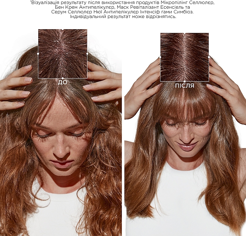Маска для поврежденных волос, склонных к появлению перхоти - Kerastase Symbiose Masque Revitalisant Essentiel — фото N3