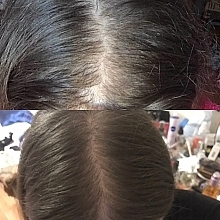 Сыворотка для роста волос "Мультиактивный комплекс" с экстрактом шишек хмеля - Hillary Multi-Active Hop Cones — фото N4