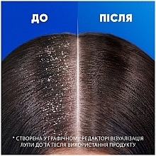 Шампунь против перхоти для чувствительной кожи головы - Head & Shoulders Sensitive Scalp Care — фото N5