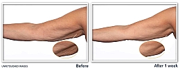 Укрепляющий и разглаживающий крем для зрелой кожи - Roc Multi Correxion Crepe Repair Targeted Treatment — фото N3