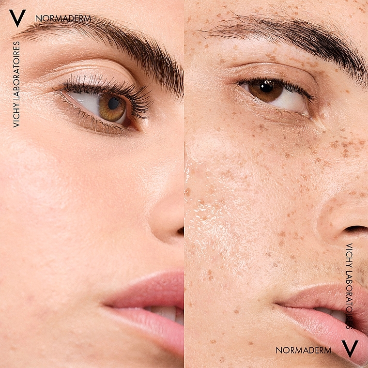 Мицеллярная вода 3-в-1 для снятия макияжа и очищения кожи лица и вокруг глаз - Vichy Normaderm 3-in-1 Purifying Micellar Water — фото N9