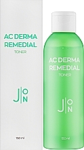 Тонер для проблемної шкіри - J:ON AC Derma Remedial Toner — фото N2