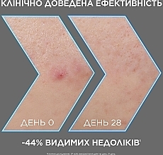 Сыворотка-пилинг с углем против недостатков кожи лица - Garnier Pure Active AHA+BHA Charcoal Serum — фото N4