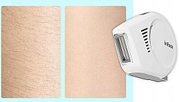 Лазерный эпилятор, белый - inFace Ipl Hair Removal Ii Zh-01F White — фото N6