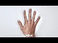Насичений живильний крем для рук з маслом ши для сухої чи дуже сухої шкіри рук та нігтів - Mixa Hand Cream Intense Nourishment — фото N1