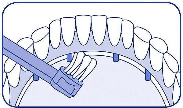 Монопучкова зубна щітка, бузкова - Curaprox CS 708 Implant — фото N3