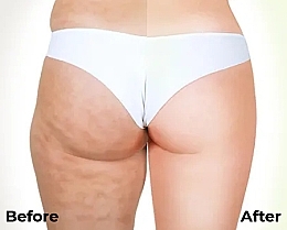 Набір "Курс розігрівальних антицелюлітних обгортань для тіла" - Hillary Anti-Cellulite Pro — фото N7