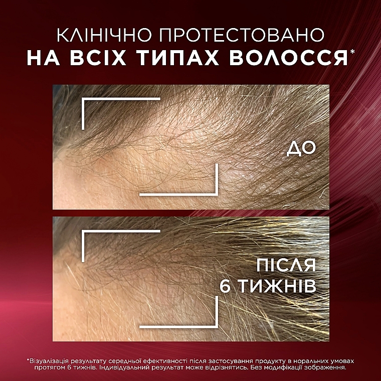 Сироватка для ослабленого волосся, схильного до випадіння - L'Oreal Paris Elseve Full Resist Arginine + Aminexil — фото N6