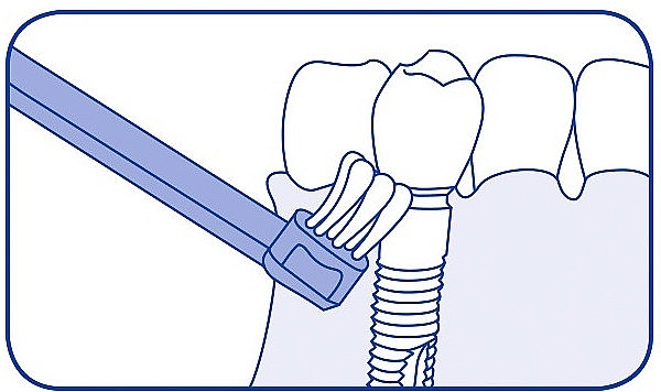 Монопучкова зубна щітка, бузкова - Curaprox CS 708 Implant — фото N6