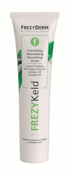 Нежный крем против рубцов - Frezyderm Frezykeld Scar Remodeling Cream — фото N1