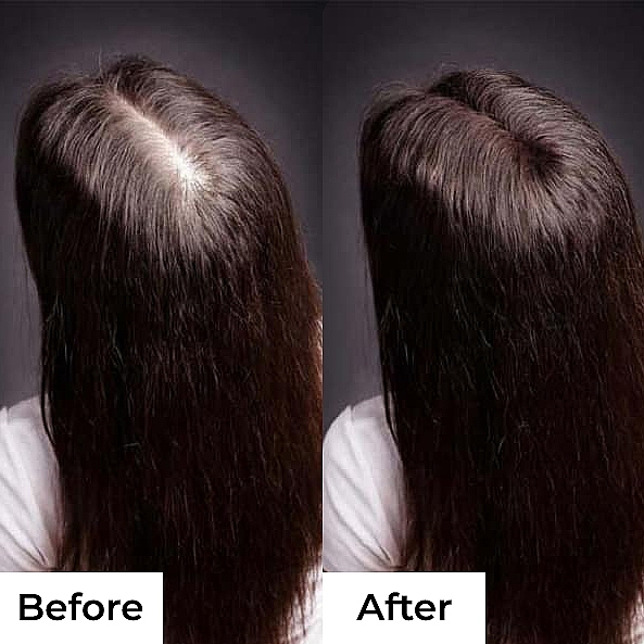 Набір "Комплекс для росту волосся" - Hillary Hop Cones & B5 Hair Growth Invigorating (sh/250ml + cond/250ml + mask/200ml) — фото N17