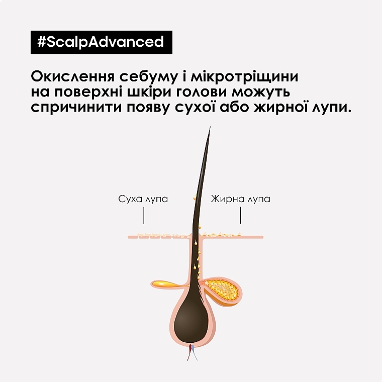 Професійний дерморегулювальний шампунь проти лупи - L'Oreal Professionnel Scalp Advanced Anti Dandruff Shampoo — фото N5