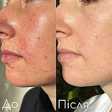 Набір для усіх типів шкіри обличчя - Hillary (ser/30 ml + ubtan/50g+ser/10 ml) — фото N11