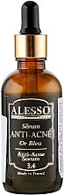 Духи, Парфюмерия, косметика Анти-акне сыворотка "Синее золото" - Alesso Professionnel Blue Gold Anti-Acne Serum