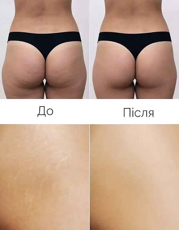 Медовое антицеллюлитное SPA обертывание - Reclaire Honey Anti-Cellulite SPA Wrap — фото N6