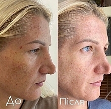 Регенерирующая сыворотка с био-ретинолом и скваланом - Hillary Bakuchiol & Olive Squalane Skin Renewal Serum — фото N4