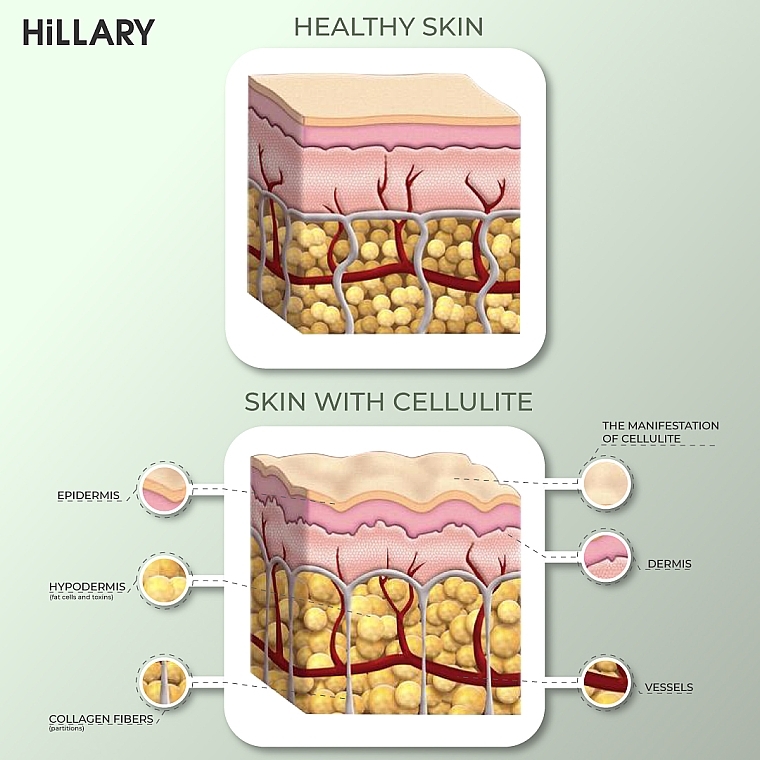 Антицеллюлитные обертывания с разогревающим эффектом - Hillary Anti-cellulite Bandage Warming Effect — фото N2