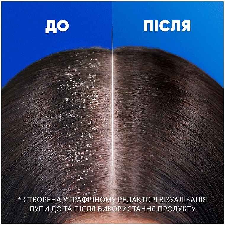 Шампунь против перхоти "Цитрусовая свежесть" - Head & Shoulders Citrus Fresh — фото N6