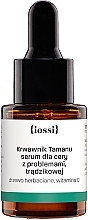 Парфумерія, косметика Сироватка для проблемної шкіри - Iossi Serum For Face (міні)