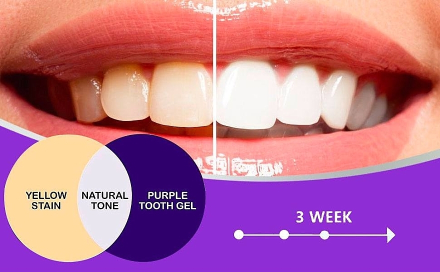 Відбілювальна зубна паста - Smilekit V34 Colour Corrector — фото N6