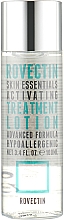 Интенсивный увлажняющий лосьон для лица - Rovectin Skin Essentials Activating Treatment Lotion — фото N1