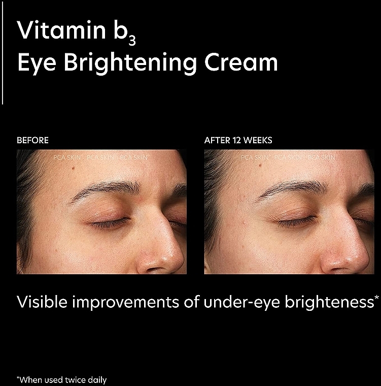 Освітлювальний крем для повік - PCA Skin Vitamin B3 Eye Brightening Cream — фото N3
