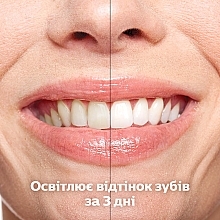 Электрическая зубная щетка - Philips DiamondClean 9000 HX9917/88 — фото N6
