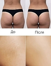 Медовое антицеллюлитное SPA обертывание - Reclaire Honey Anti-Cellulite SPA Wrap — фото N6