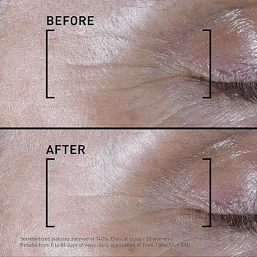 Інтенсивна сироватка для обличчя - Filorga Time-Filler Shot 5XP Concentrated Serum — фото N8