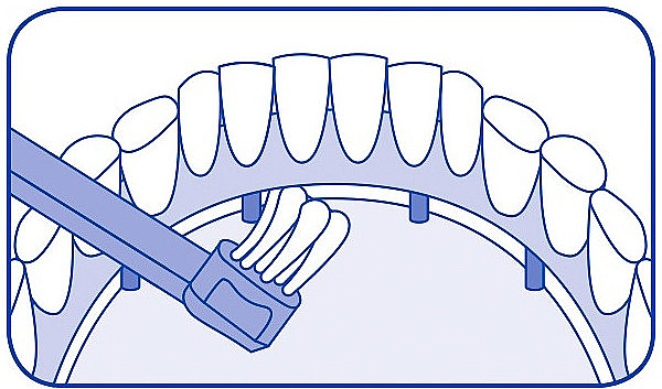 Монопучкова зубна щітка, синя - Curaprox CS 708 Implant — фото N5