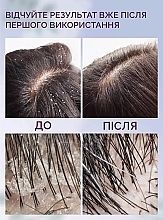 Пилинг для жирной кожи головы с AHA и BHA кислотами - Reclaire Scalp Peel — фото N7