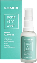 Сыворотка против акне - Feedskin Acne Remover Serum — фото N2