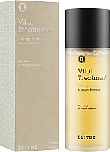 Есенція для обличчя - Blithe Vital Treatment 5 Energy Roots — фото N4