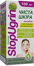 Парфумерія, косметика Лосьйон з рослинними екстрактами "Стопугрін" - Вертекс StopUgrin